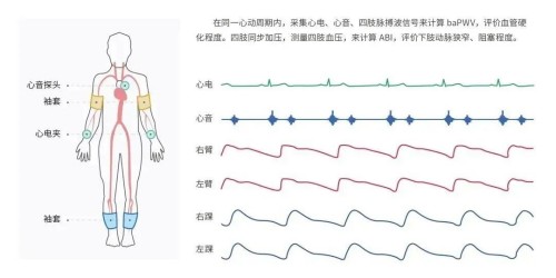 監(jiān)測(cè)部位